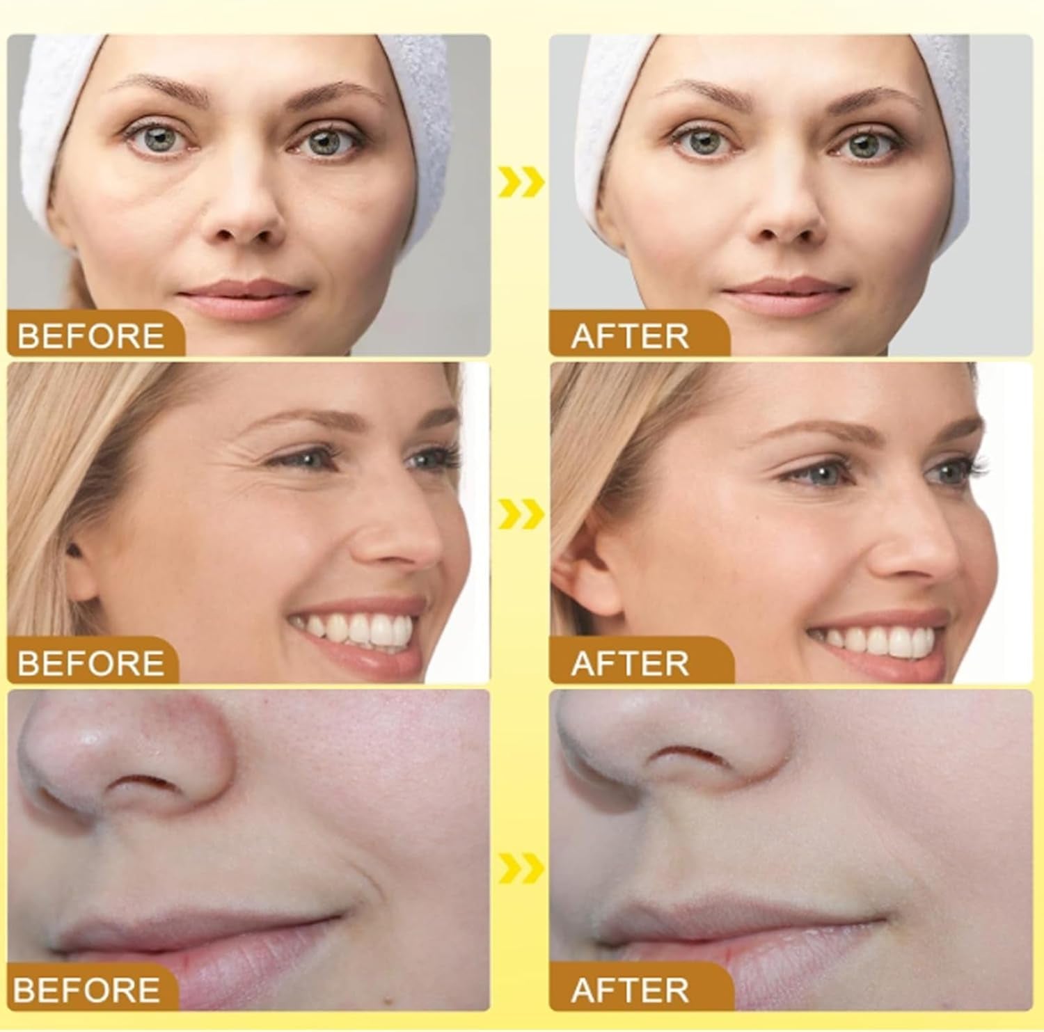 Bee Venom Anti-Wrinkle Cream,Bee Venom Skin Treatment Cream,Anti Wrinkle Cream,Boto-X Bee Venom Wrinkle Removal Cream,Bee Venom Cream for Neck & Face,Face Moisturizer,Bee Venom Firming Body Cream