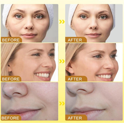 Bee Venom Anti-Wrinkle Cream,Bee Venom Skin Treatment Cream,Anti Wrinkle Cream,Boto-X Bee Venom Wrinkle Removal Cream,Bee Venom Cream for Neck & Face,Face Moisturizer,Bee Venom Firming Body Cream