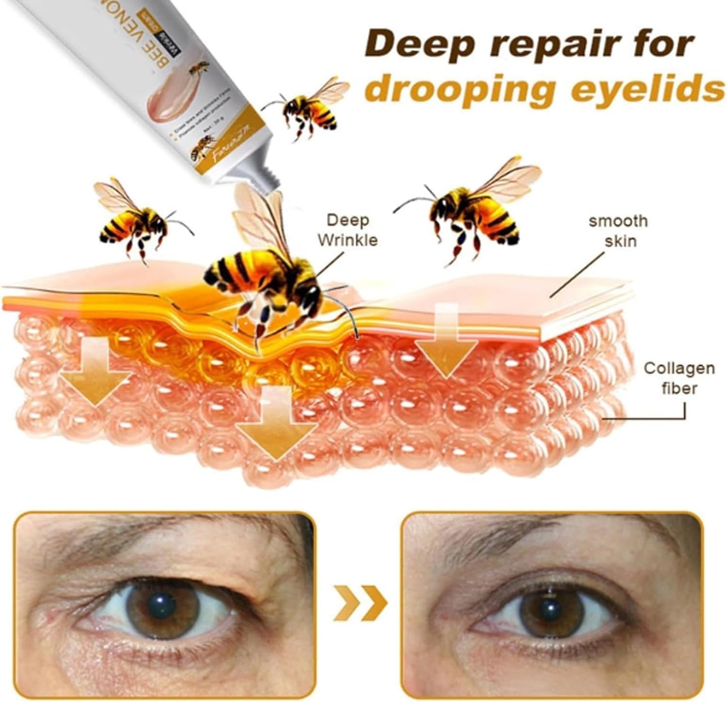 Bee Venom Anti-Wrinkle Cream,Bee Venom Skin Treatment Cream,Anti Wrinkle Cream,Boto-X Bee Venom Wrinkle Removal Cream,Bee Venom Cream for Neck & Face,Face Moisturizer,Bee Venom Firming Body Cream